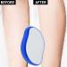 WFRAU Men & Women Painless Crystal Hair Eraser & Skin Exfoliator Tool - Magic Crystal Hair Removal for Arms Legs Back for Body Any Part (blue new) - Buy Online on GoSupps.com