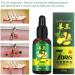 Ginger Germinal Oil Hair Growth Oil 2019 Hair Growth Serum Ginger Germinal Essential Oil Hair Loss Treatment Hair Care Hair Growth Serum Repairs Hair Follicles Promotes Thicker Hair Regrowth-30ml - Buy Online on GoSupps.com