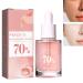 Peach Essence 70% Niacinamide Serum Anti-Aging Face Serum with Peach Essence Brightening Hydrating Face Serum Anti-aging Face Serum with Peach Extract Brightening and Hydrating Skincare
