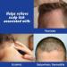 Scalpicin Max Strength Scalp Itch Treatment - 1.5 oz (Pack of 2) | Fast Shipping Worldwide - Buy Online on GoSupps.com
