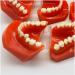 Teeth Educational Model - Orthodontic Classification & Lesson Model for Dental Training | International Shipping Available - Buy Online on GoSupps.com