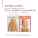 AMOS PROFESSIONAL Repair Cica Protein Leave-in Treatment | Anti-Frizz Deep Conditioner for Split Ends & Breakage | 5.0 fl. oz - Shop Internationally for Healthy Hair - Buy Online on GoSupps.com