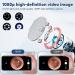 MIIKUU 1920p WiFi Otoscope Ear Wax Removal Camera | 360 Waterproof Endoscope with 6 LEDs | Compatible with iPhone iPad & Android - Buy Online on GoSupps.com