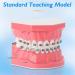 Buy Dental Demonstration Orthodontic Model with Metal Wires & Bracket - Ideal for Teaching Brushing & Flossing Practices - Buy Online on GoSupps.com