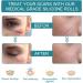 Premium Silicone Scar Removal Band - 1.6 x 60 Rolls | Effectively Treat Old & New Scars Keloids & Acne Scars - Fast International Shipping - Buy Online on GoSupps.com