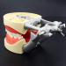 Lmeili Dental Typodont Joint Model - Removable Teeth Anatomy Teaching Tool for Dental Study - Buy Online on GoSupps.com