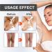 Snow Bleach Cream for Intimate Areas | Skin Lightening & Dark Spot Remover - Effective Underarm Neck Knee & Elbow Treatment - Buy Online on GoSupps.com