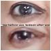 Advanced Anti-Aging Eye Treatment Serum for Rapid Reduction of Under-Eye Bags, Wrinkles, and Fine Lines - Brightening Formula with Niacinamide and Hyaluronic Acid - Buy Online on GoSupps.com