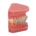 Typodont Orthodontic Tooth Model (28 Teeth) - Complete representation of crowded teeth malocclusion open jaw