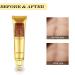 3 Pack TCM Scar Removal Cream for Surgical Scars, Acne Treatment, Burns, Stretch Marks - Skin Care Cream for Acne Spots - Buy Online on GoSupps.com