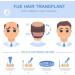Hair Follicle Extractor Instrument - Adjustable 3-Speed Mode Scar-Free Solution for Hair Loss & Thinning Hair - International Shipping Available - Buy Online on GoSupps.com