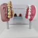 Upikit Dental Model for Sick Teeth - Compare Smoking vs Normal Teeth | Ideal for Medical Demonstrations - Buy Online on GoSupps.com