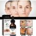 Melanin Correcting Face Serum Dark Spot Correcting Serum Moisturizing Repairing Face Serum Hydrate Anti-Wrinkle Facial Essence Collagen Face Serum Firms and Rejuvenates Skin - Buy Online on GoSupps.com