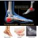 Best Heel Cushion Cups for Plantar Fasciitis | Pain Relief Insoles - International Shipping - Buy Online on GoSupps.com