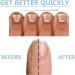 Onyxoguard Serum Onyxoguard Nail Growth and Repair Serum Onyxoguard Nail Serum Onyxoguard Nail Repair Serum Nail Growth and Strengthener Essence for Thin Nails and Growth (3PCS) - Buy Online on GoSupps.com