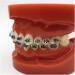 ERNZI Typodont Teeth Model | Dental Orthodontic Demonstration for Science Teaching | International Shipping Available - Buy Online on GoSupps.com