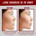 Jaw Exerciser Set (6 Pcs) - 3 Resistance Levels for Men & Women | Silicone Jawline Trainer - Shape & Tone Your Face - Buy Online on GoSupps.com