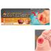 Bedsore Cream Pressure Sore Relief Cream Bed Sore Cream Fast Acting Fast Wound Healing Gel 20g