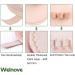 Welnove Toe Straightener Hammer Toe Corrector Pack of 2 - 3 Hole Splint for Claw Toe, Mallet Toe, Contracted Toe - Toe Straightener and Corrector for Improved Comfort and Alignment - Buy Online on GoSupps.com