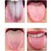 Anoudon 2pcs Tongue Cleaner - Plastic Scraper for Optimal Mouth Health | International Shipping Available - Buy Online on GoSupps.com