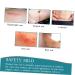 Healvian Silicone Gel Scar Patch Stickers - Skin Recovery Tape for Surgery - 1 Roll - Buy Online on GoSupps.com