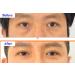 WHITESILK & Wisely Stem cell Hydrating & Wrinkle Super Vital EYE Cream with 9-Exosome Matrixyl 3000 5-nano Hyaluronic Acid by Botaniceutical Plus-10 Wrinkle Technology (30ml) - Buy Online on GoSupps.com
