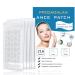 Acne pavement 216 pieces invisible hydrocolloid pavement effectively relieve acne pimples patch frequent for facial care suitable for all skin types