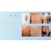 Silicone Scar Sheets - C Section & Post-Op Recovery Tape for Stretch Marks & Keloid Treatment - 4cm x 1.5m - Buy Online on GoSupps.com