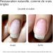 R paration d'Ongles Fendus - Gel Colle | Gel R parateur pour Ongles Ab m s Manucure Quotidien Femmes Filles R paration Fissures Entretien Journalier - Buy Online on GoSupps.com