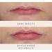 Droplette 17-Volt Lip Plumper Refill | 14 Count - Buy Online on GoSupps.com