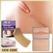 WAITLOVER Skin Color Reusable Silicone Scar Removal Patch - Surgical Self-Adhesive Soft Gel Strip for Burn Repair - Buy Online on GoSupps.com