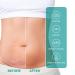 2Pcs Scar Remove Advanced Spray - Remove Dark Acne, Surgical Scars & Stretch Marks - Buy Online on GoSupps.com