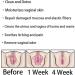 DENGWANG Anniecare Natural Repair Viginal Capsules - 2 Boxes - Buy Online on GoSupps.com