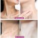 EXQST Mango Neck Firming Cream Mango Neck Firming Regenerating Cream Anti-aging firms sagging skin and reduces wrinkles - Buy Online on GoSupps.com