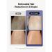 Ulike Laser Hair Removal for Women and Men Long-Lasting IPL Hair Removal Device with Ice-Cooling for Nearly Painless Treatment for Facial Bikini & Whole Body - Buy Online on GoSupps.com