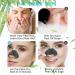 INGJIA Blackhead Strips Nosestripes Blackheads Pore Strips Anti Blackhead Nose Strips Remove Blackheads and Impurities Pore Strips for Blackheads Plus Tool for Removing Blackheads - Buy Online on GoSupps.com