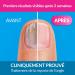 Excilor Treatment for Nail Mycosis Solution 3.3ml - Buy Online on GoSupps.com