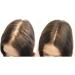 Natural Keratin Hair Fibre Refill for Hair Loss - 25g Grey (Pack of 1) | For Alopecia & Chemotherapy - Buy Online on GoSupps.com