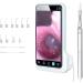EYEARN Ear Wax Removal Tool with 5-inch Screen Visual Ear Picker Endoscope Inspection Camera Portable Ears Cleaner Cleaning Kit You can See it Better from a Small Distance