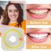 Ultra-Fine Lsojfe Tooth Sandpaper & Dental Polishing Strips - 20 m Interdental Grinding Tool 4mm Width - Buy Online on GoSupps.com