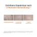 ISDIN ERYFOTONA AK Fluid LSF100+ (50 ml) | Best Protection Against Actinic Keratosis | High UVB & UVA Defense - Buy Online on GoSupps.com