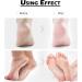 Amope Pedi Perfect Callus Remover Refills - Shell Powder Formula - 1 Extra & 4 Regular Replacements - Buy Online on GoSupps.com