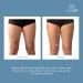 NuSkin ageLOC Body Shaping Gel | Cellulite Treatment for Contouring & Firming | Spa Quality Intensive Treatment | 150 ml for Young Looking Skin & Beauty | Making it a S tier skin care product | 2 Pack 5 Fl Oz (Pack of 2) - Buy Online on GoSupps.com