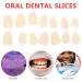 200pcs Dental Temporary Crown Veneers Kit - Tooth Repair Replacements - Beige - Buy Online on GoSupps.com