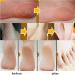 AllbestAye Foot Repair Cream - Heal Cracked Heels & Dry Feet | Moisturizing Callus Care for Soft Skin - 50g - Buy Online on GoSupps.com