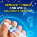 Fungal Nail Treatment Cream - Antifungal Solution for Toenail Repair & Discolored Nails - Buy Online on GoSupps.com