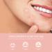 AVJONE Day and Night Hydrocolloid Acne Pimple Patch - 108+36 Vegan-Friendly Spot Stickers for Face and Skin - Buy Online on GoSupps.com