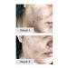 Buy NXN Acne Scar Treatment Gel | Antioxidants & Glycerin for Rapid Blemish Reduction - Effective Face & Body Solution - Buy Online on GoSupps.com