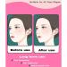 V Line Face & Neck Lift Silicone Mask - Double Chin Reducer & V-shaped Eliminator - Buy Online on GoSupps.com