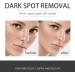 Dark Spot Remover for Face Hyaluronic Acid Dark Spot Correcting Serum Anti Aging Face Serum for Women Nicotinamide Dark Spot Correcting Glow Serum Anti Spot Face Serum and Oil Skin Moisturizer-30ml - Buy Online on GoSupps.com